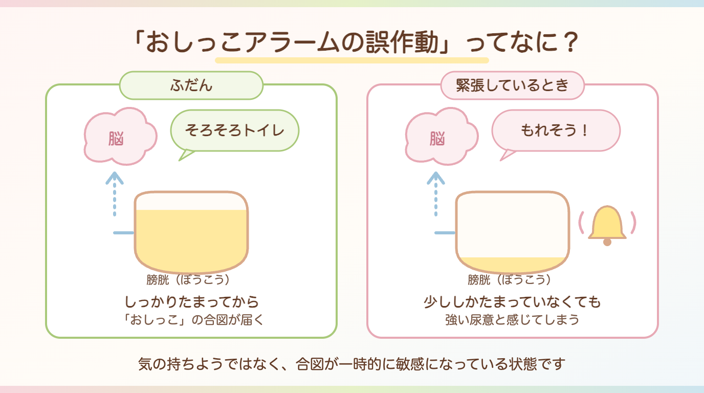 おしっこアラームの誤作動:ふだんと緊張しているときの違い